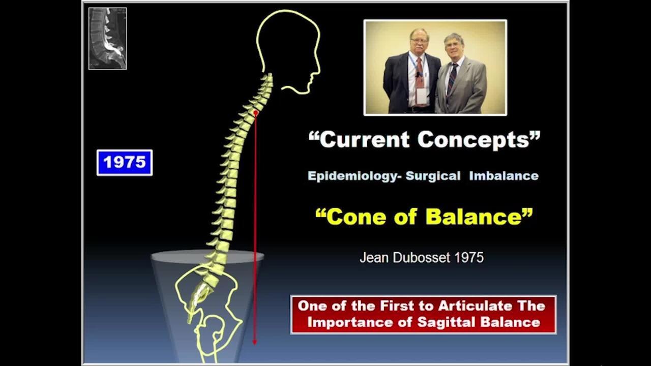 Considerations of the Aging Spine and Sagittal Plane