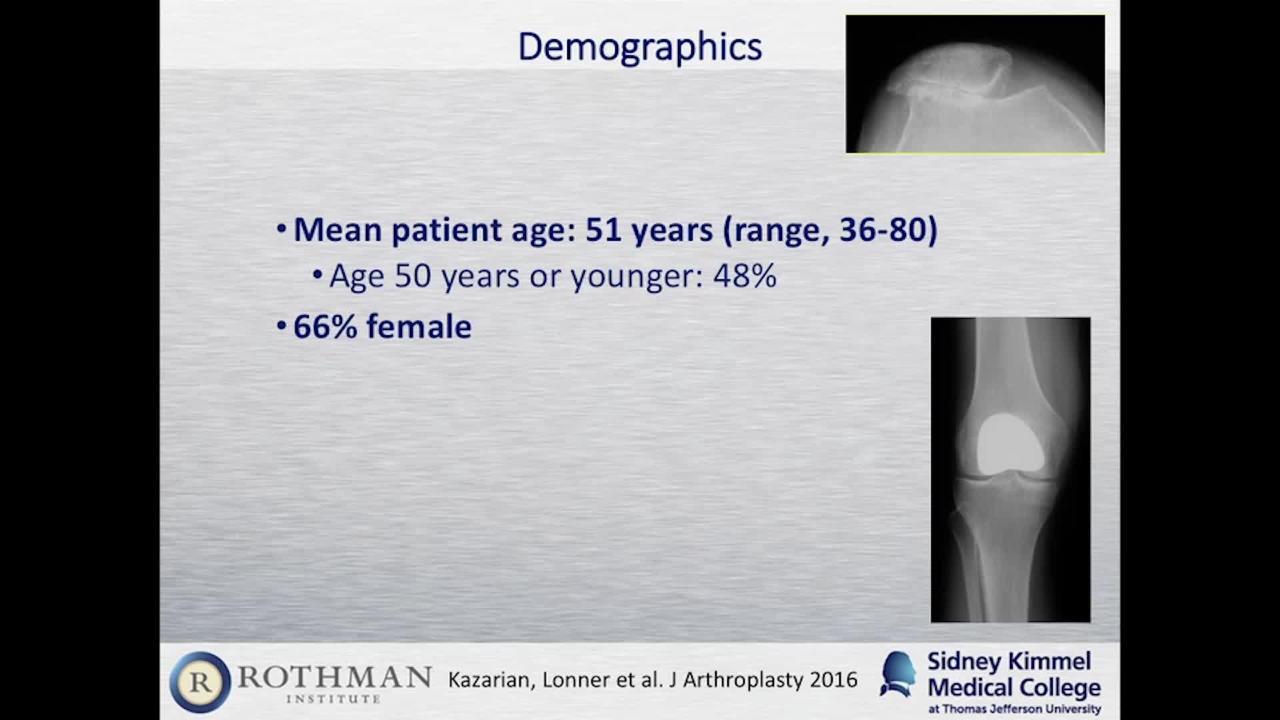 Patellofemoral Arthroplasty: Indications and Results