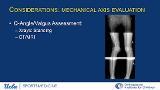 Managing Complications and Failures in Pediatric Sports Medicine