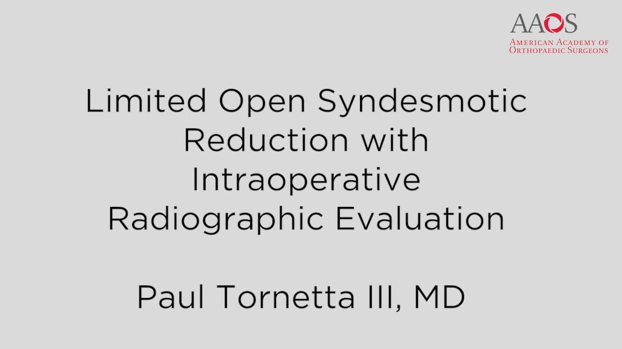 Limited Open Syndesmotic Reduction With Intraoperative Radiographic Evaluation