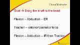 Proximal Humerus Fractures: To Fix or Not Fix?