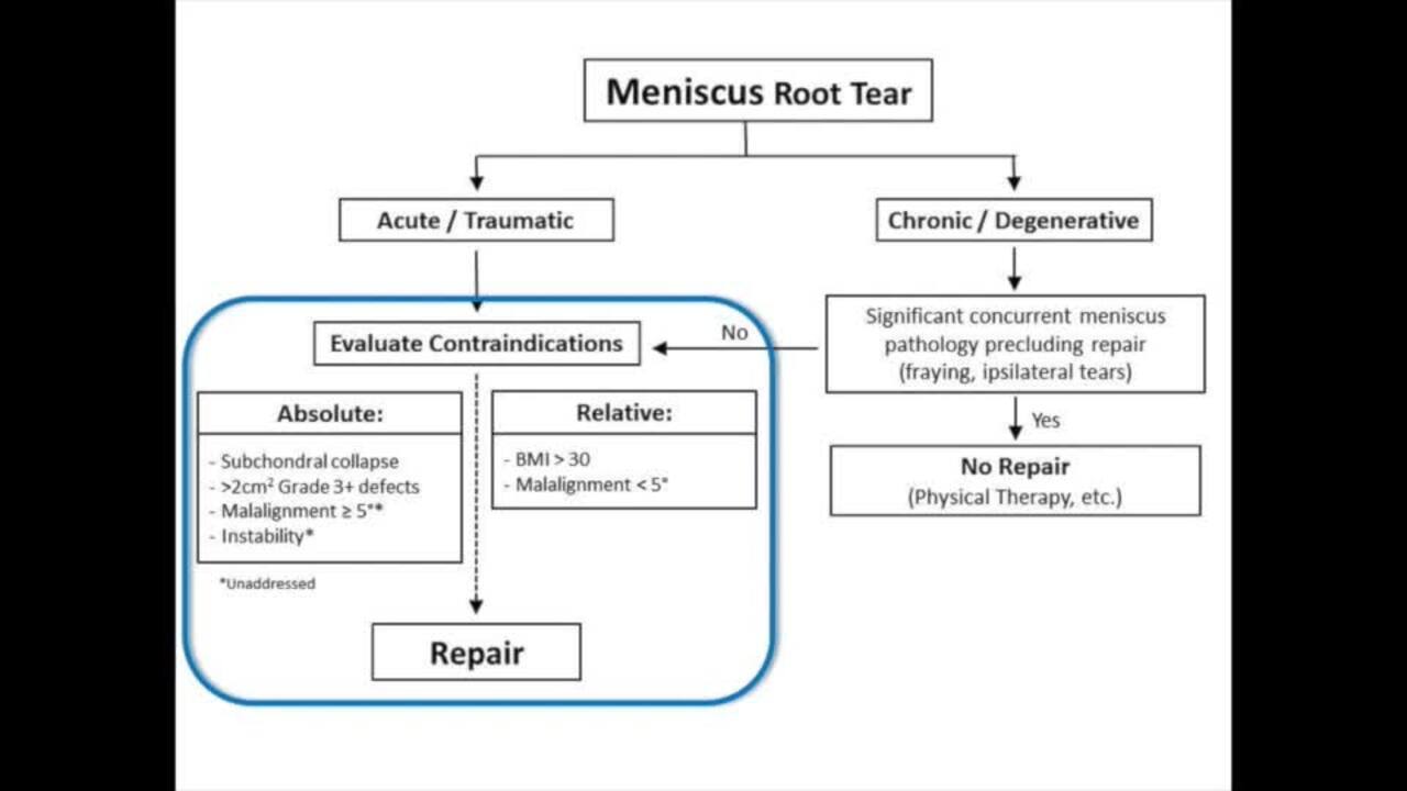 Desgarros de los meniscus (Meniscus Tears) - OrthoInfo - AAOS