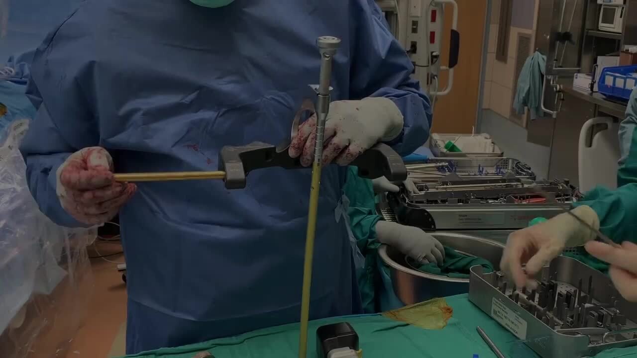Sacrectomy Video Video Details