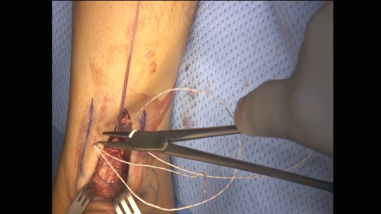 Video Details