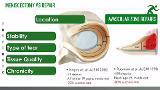 Meniscectomy – When is it Enough?