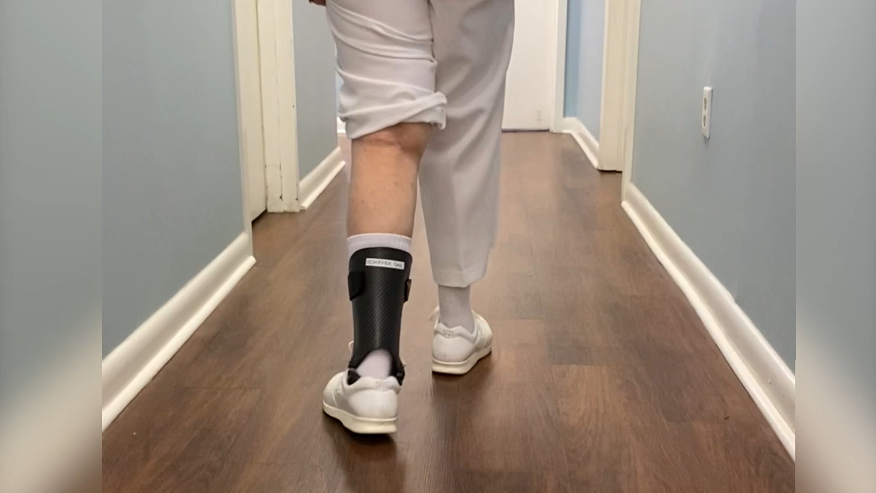 Gait Analysis of Patient After Placement of Device
