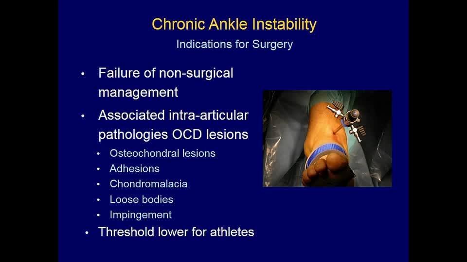 Ankle Sprains and Lateral Ankle Instability - Kenneth J. Hunt, MD