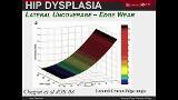 Innovations in Joint Preservation Procedures for the Dysplastic Hip: the PAO