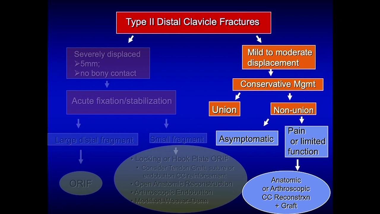 Distal Clavicle Fractures and SC Injuries