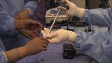 Unstable Intertrochanteric Hip Repair With a Cephalomedullary Nail