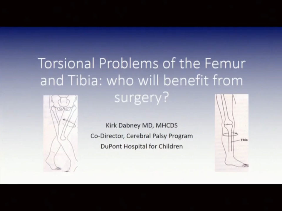 Torsional problems of the femur and tibia: Who will benefit from surgery