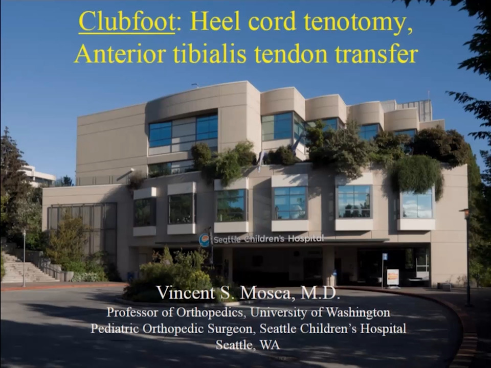 Clubfoot: Heel Cord Tenotomy Anterior Tibilias Tendon Transfer