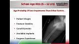 Fractures of the Femoral Shaft: An Algorithm Based on Age and Fracture Stability