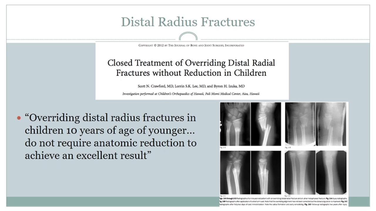 The Office Management of Common Pediatric Fractures: Forearm, Wrist & Hand
