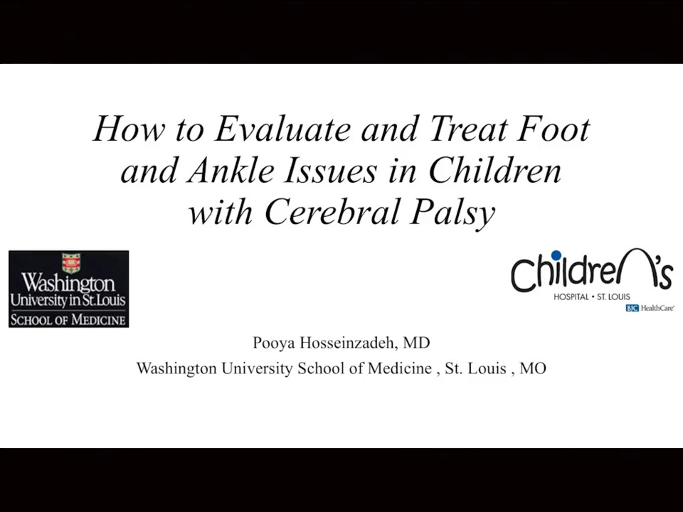 How to evaluate and treat foot and ankle issues in children with cerebral palsy