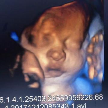 Photo of Hello Baby Ultrasound - Miami, FL, US.