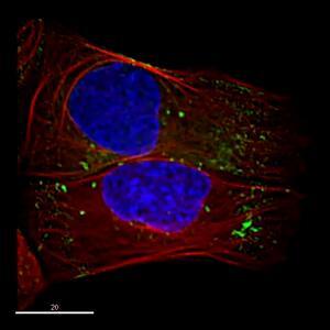 CellLight™ Early Endosomes-GFP, BacMam 2.0 1 mL | Buy Online CellLight™ Early Endosomes-GFP, BacMam 2.0 1 mL | Buy Online