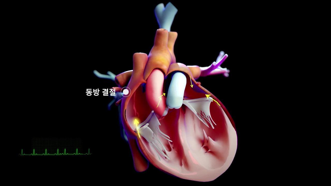 심장 및 혈관 장애 개요