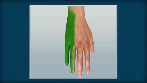 How To Do an Ulnar Nerve Block