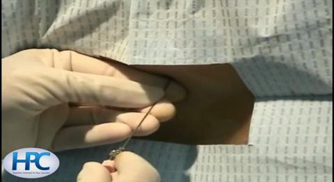 Spinal Needle Sizes(lumbar puncture needle)