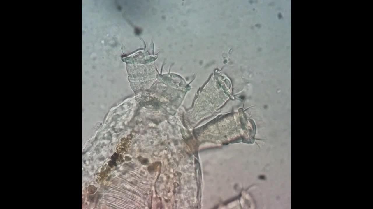<i >Apiosoma</i>, gill, oscar (<i >Astronotus ocellatus</i>)
