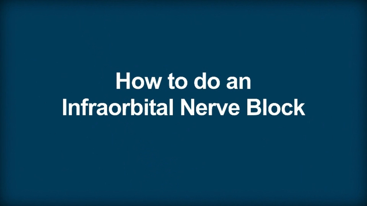How To Do an Infraorbital Nerve Block
