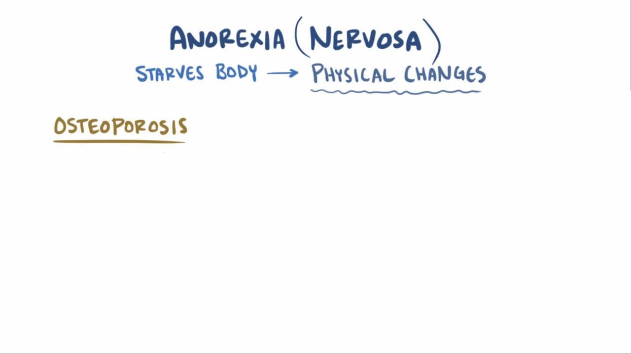 Overview of Anorexia Nervosa
