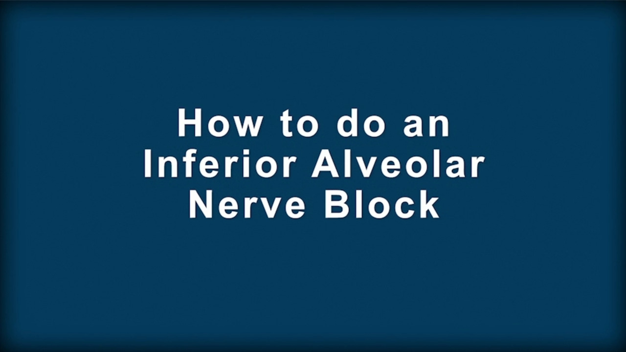 How To Do an Inferior Alveolar Nerve Block