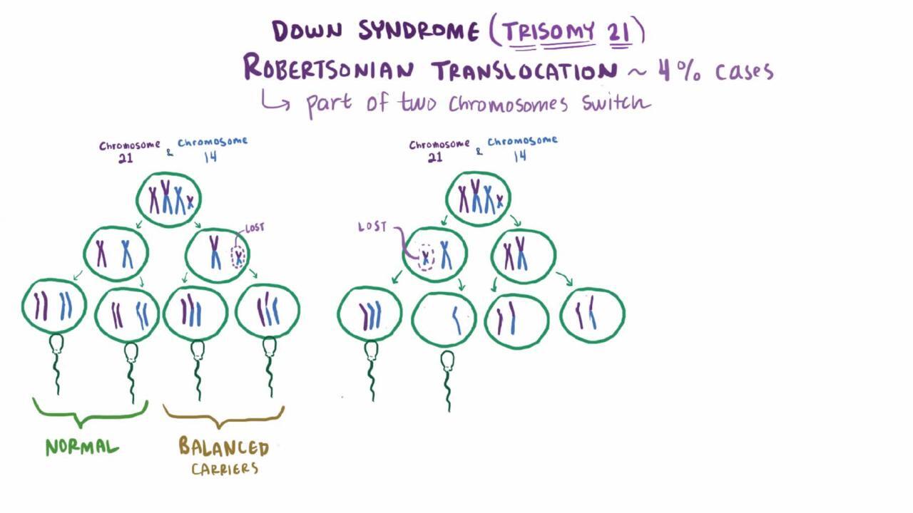 double trisomy