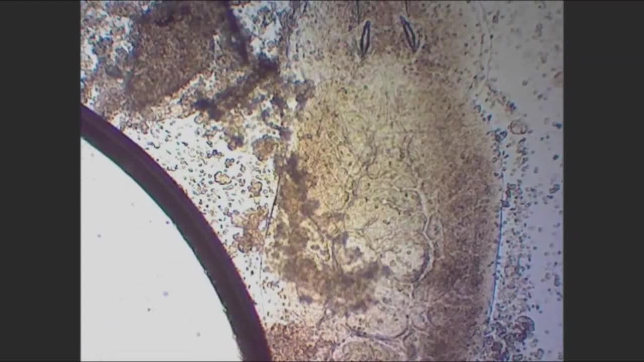 Capasalid monogenean, skin, mimic tang (<i >Acanthurus pyroferus</i>)
