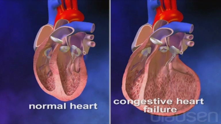 Когда при учащенном сердцебиении необходимо обратиться к врачу?