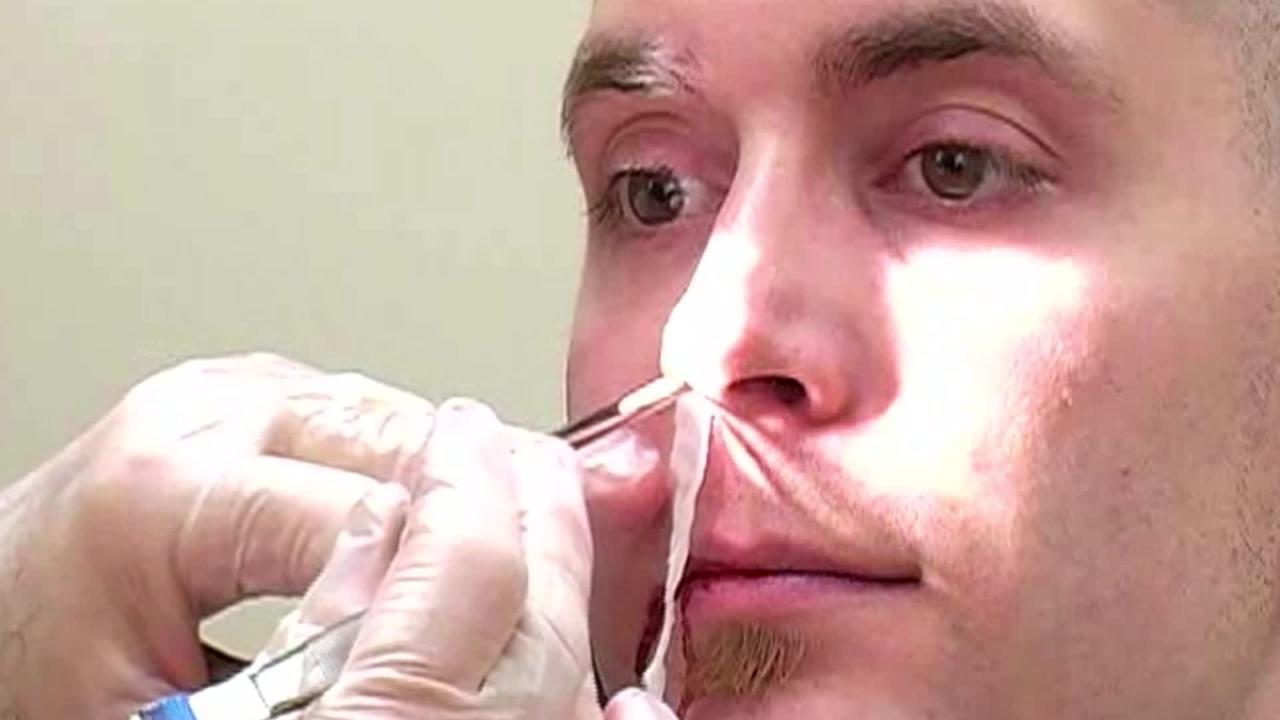 Saignement de nez après un test PCR , quoi faire ? Narine qui
