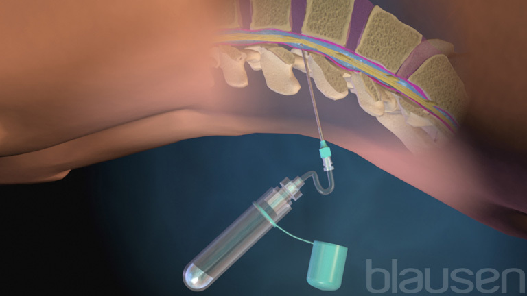 Tests For Brain Spinal Cord And Nerve Disorders Brain Spinal Cord And Nerve Disorders