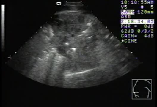 Rhodococcus equi Pneumonia in Foals - Respiratory System - MSD ...