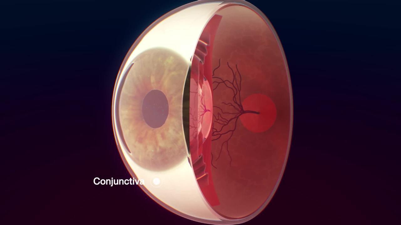 allergic conjunctivitis discharge