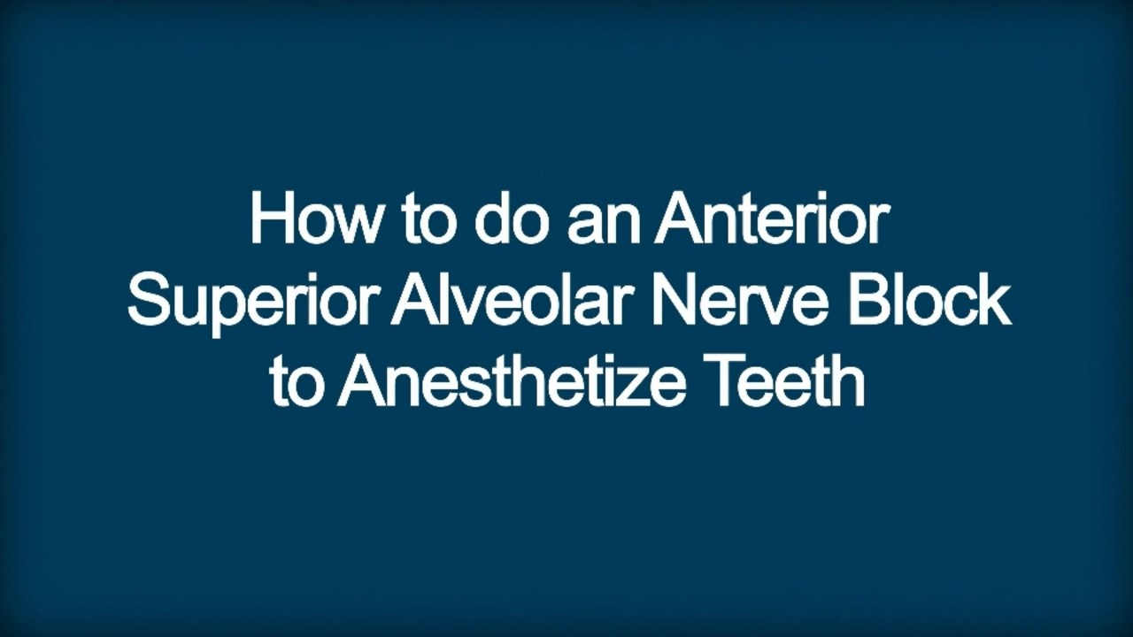 How To Do an Anterior Superior Alveolar Nerve Block to Anesthetize Teeth