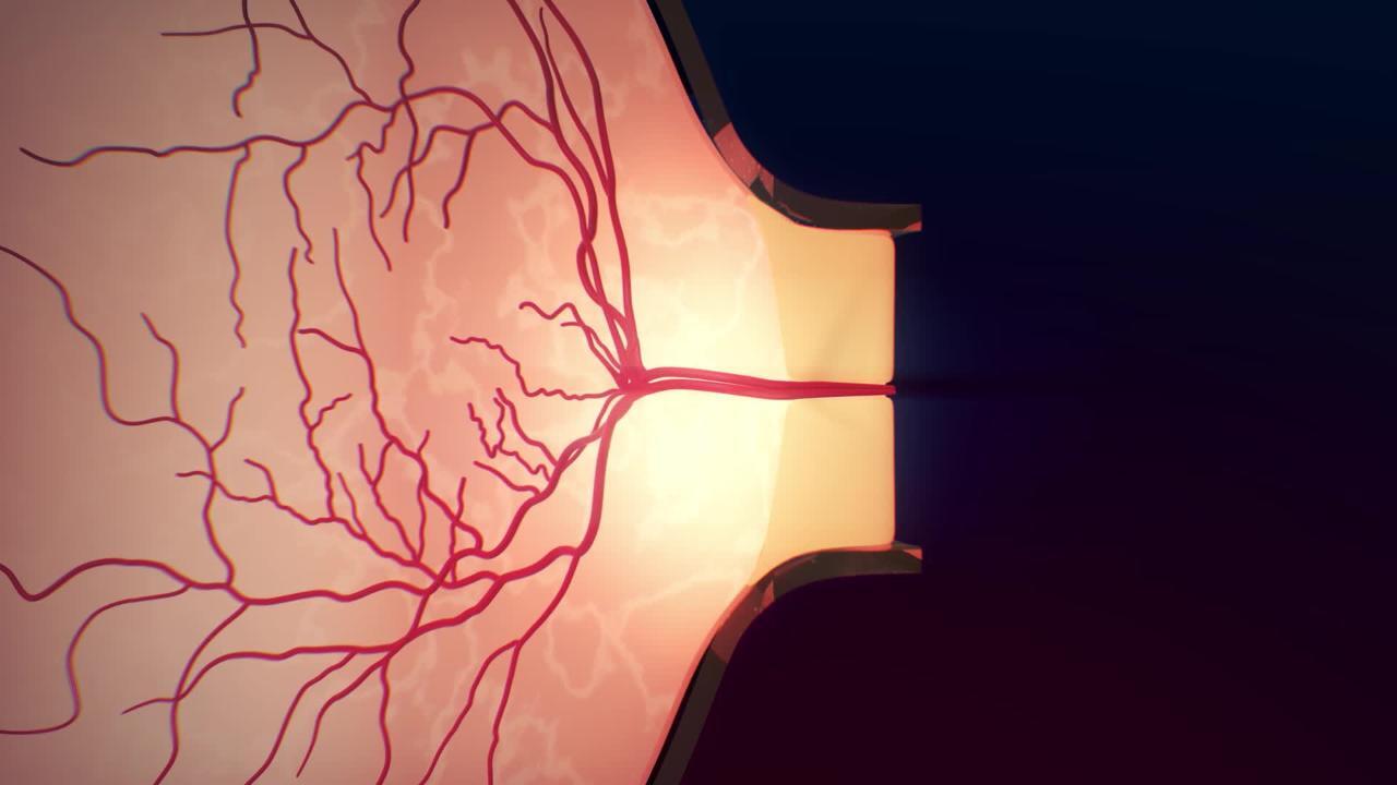 How to Improve the Health of the Retina?