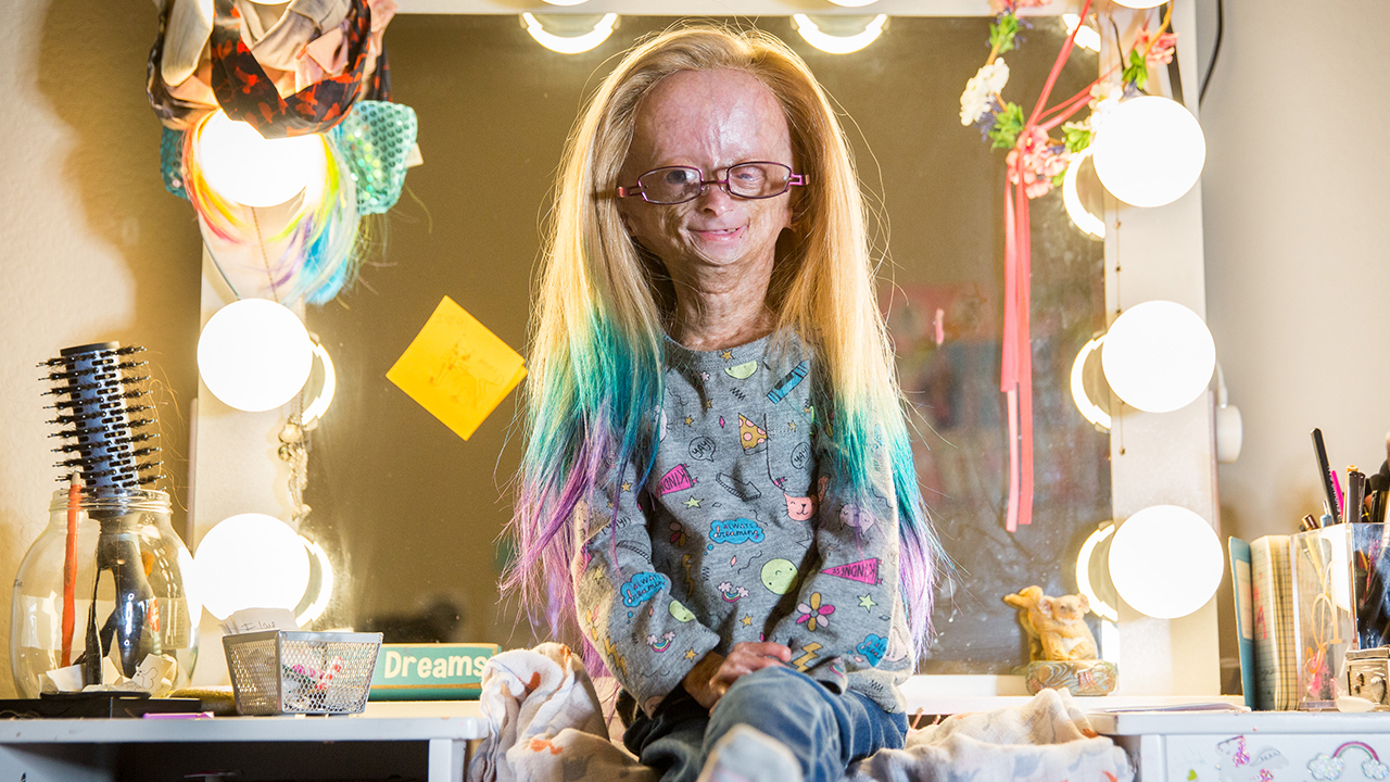 Little Girl With Rapid Aging Disease Is An Internet Superstar