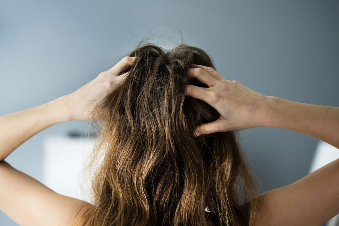 5 Surprising Scalp Facts You Didn't Know Are Impacting Hair Health