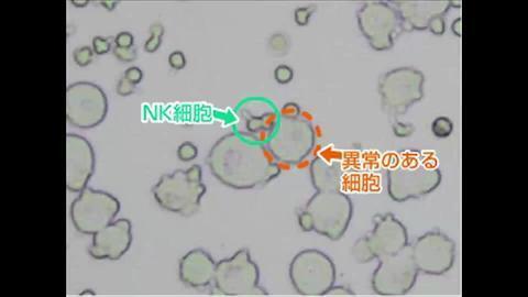 Nk細胞の動き 明治ヨーグルトライブラリー