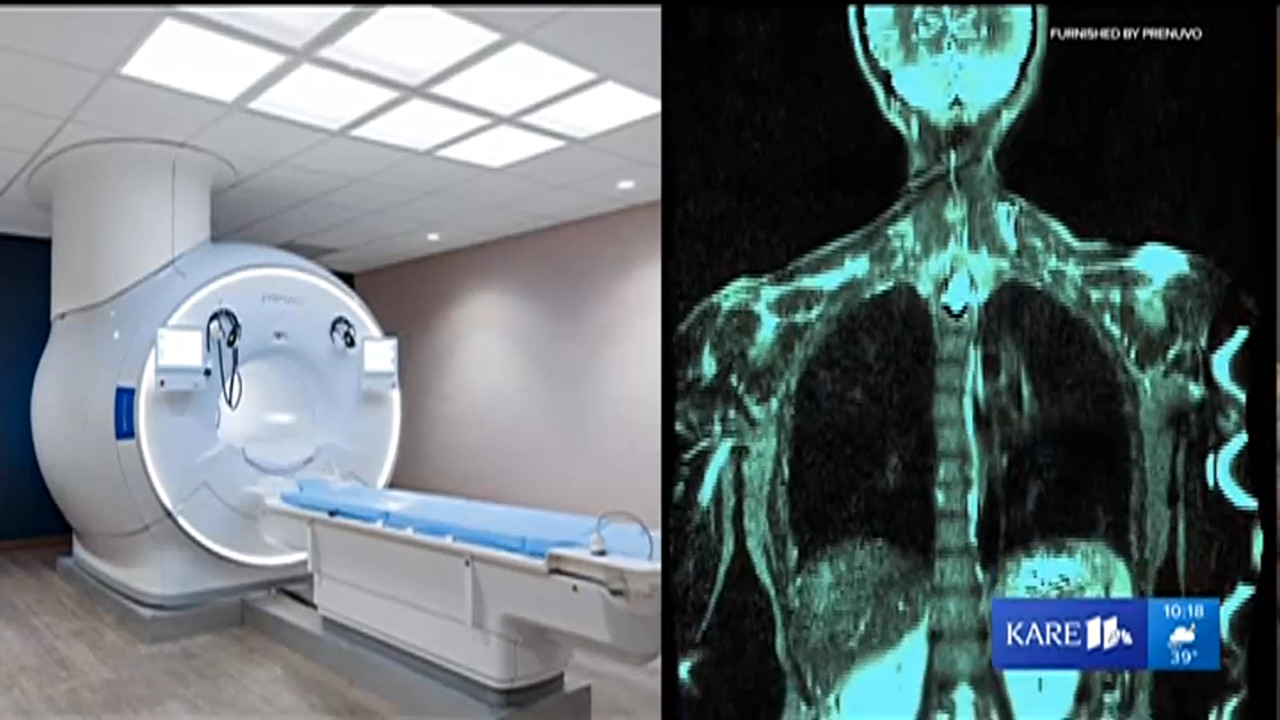 Prenuvo offers $2,500 full-body MRI scans that can detect cancer early