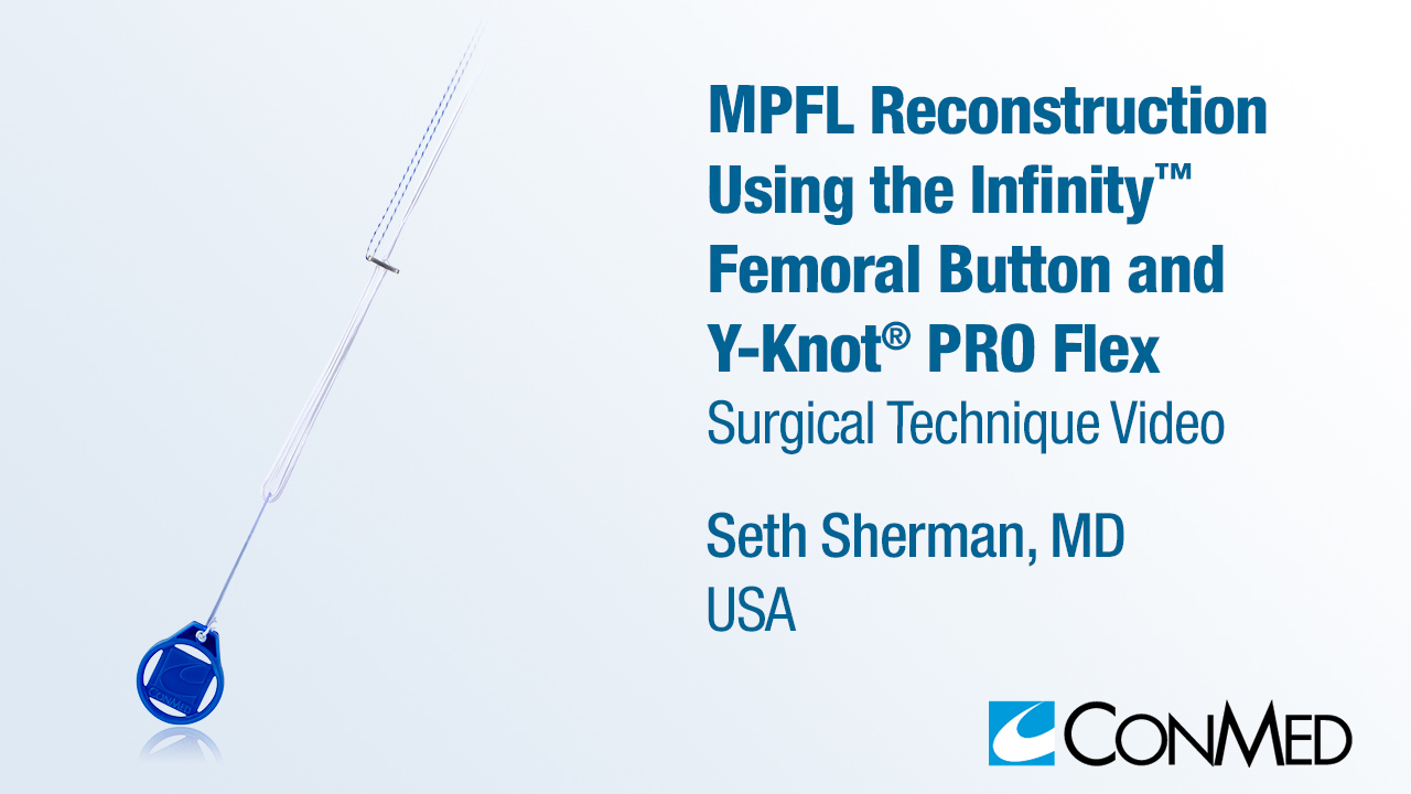 Dr. Sherman - MPFL Reconstruction Using the Infinity™ Femoral Button and  Y-Knot® PRO Flex - Patellar Instability - CONMED VIDEO GALLERY