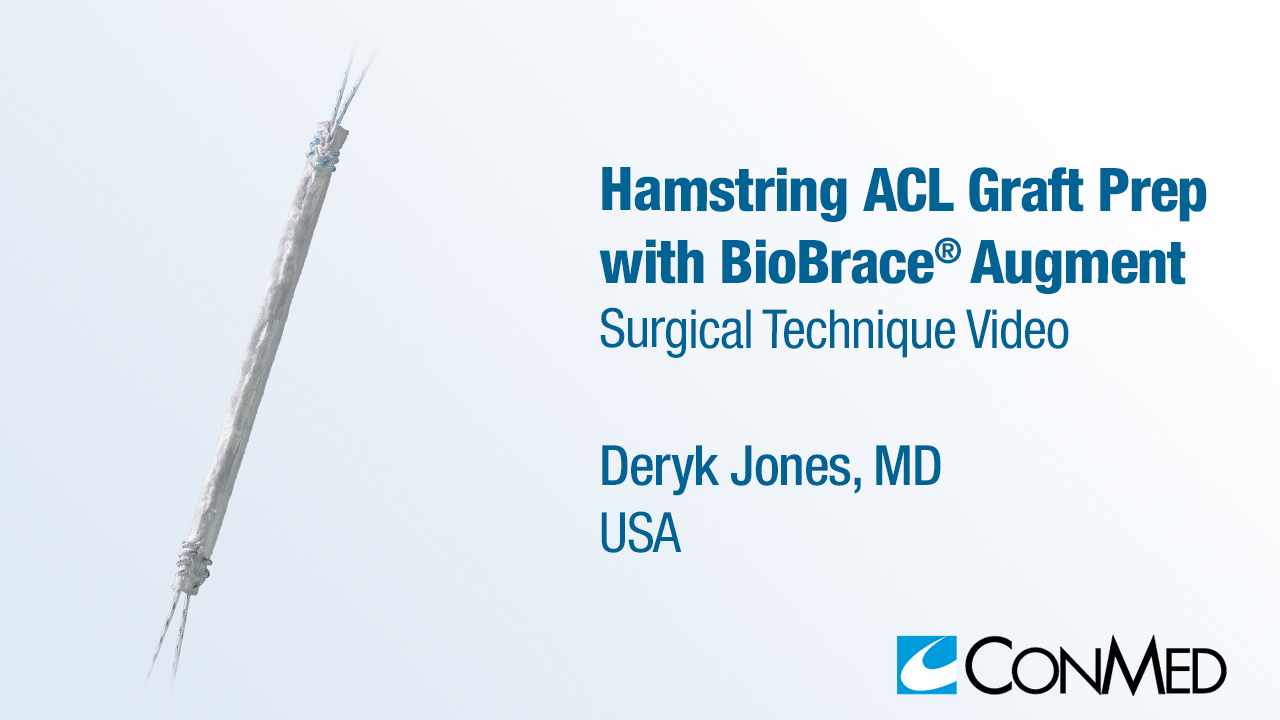 Dr. Jones - Hamstring ACL Graft Prep  with BioBrace® Augment