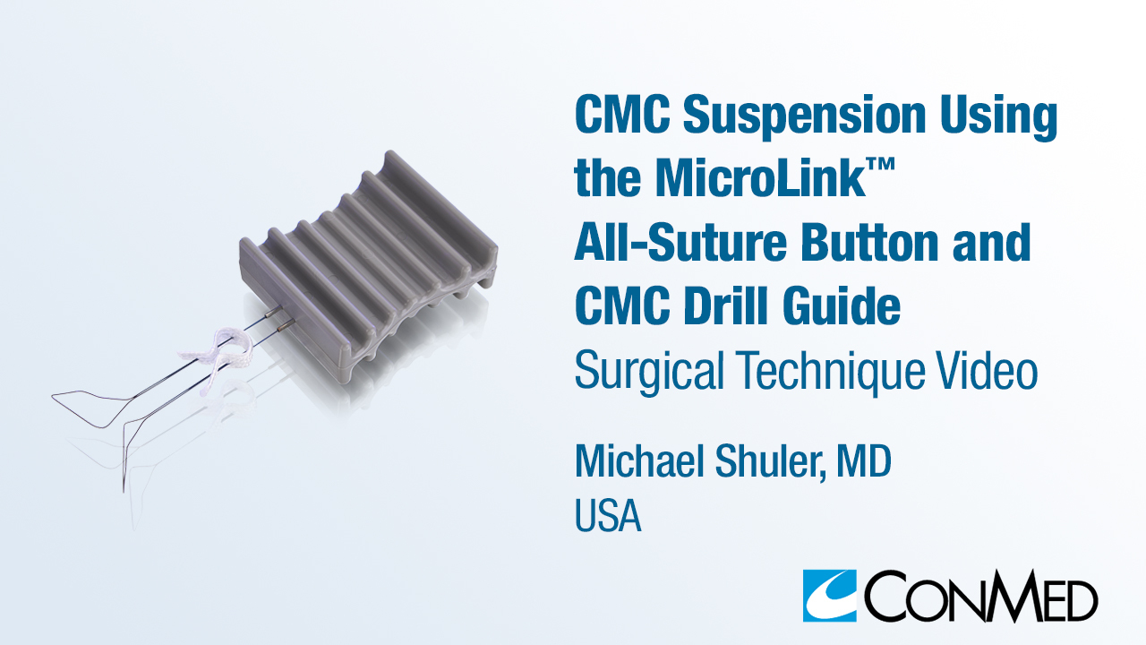 Dr. Shuler - CMC Suspension Using the MicroLink™ All-Suture Button and CMC Drill Guide