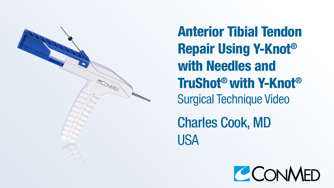 Dr Cook - Anterior Tibial Tendon Repair Using Y-Knot® with Needles, TruShot® with Y-Knot®, and GENESYS Matryx®  Interference Screw