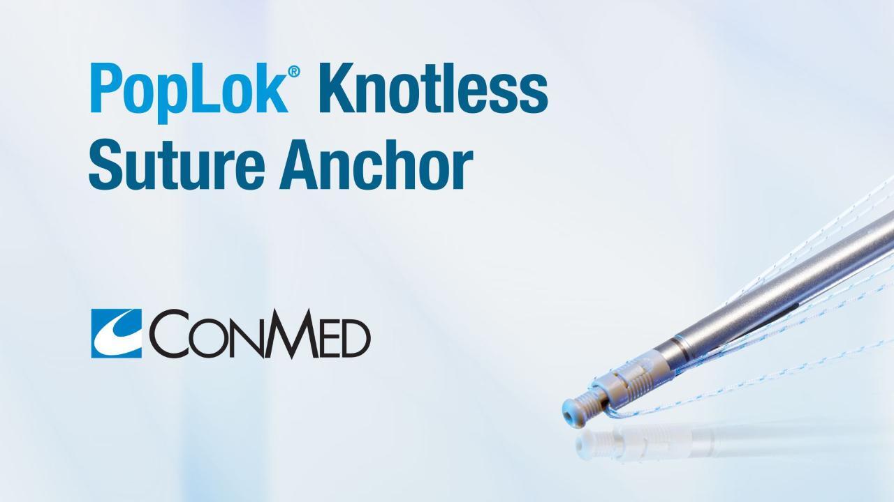 PopLok® Knotless Suture Anchor - Product Video