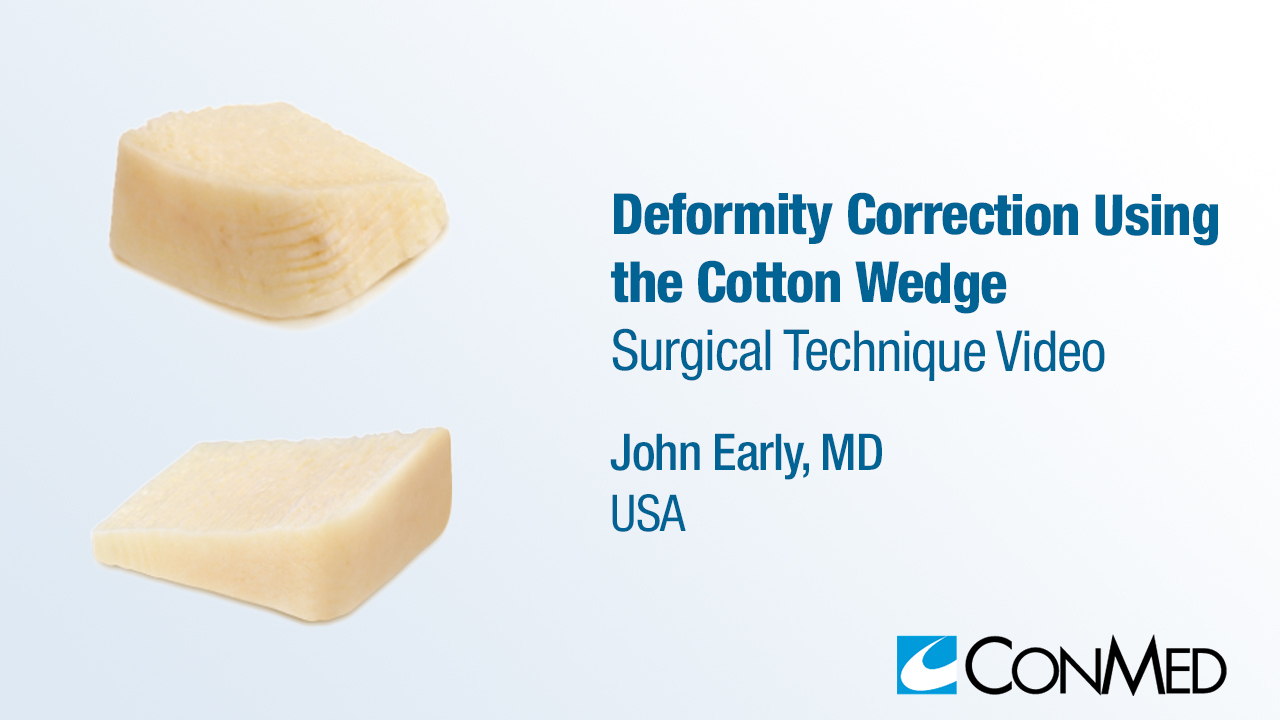 Dr. Early - Deformity Correction Using the Cotton Wedge