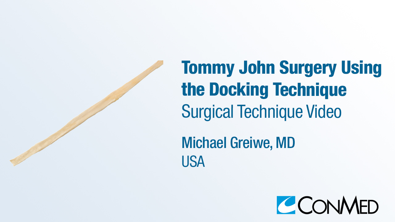 Dr. Greiwe - Tommy John Surgery Using the Docking Technique