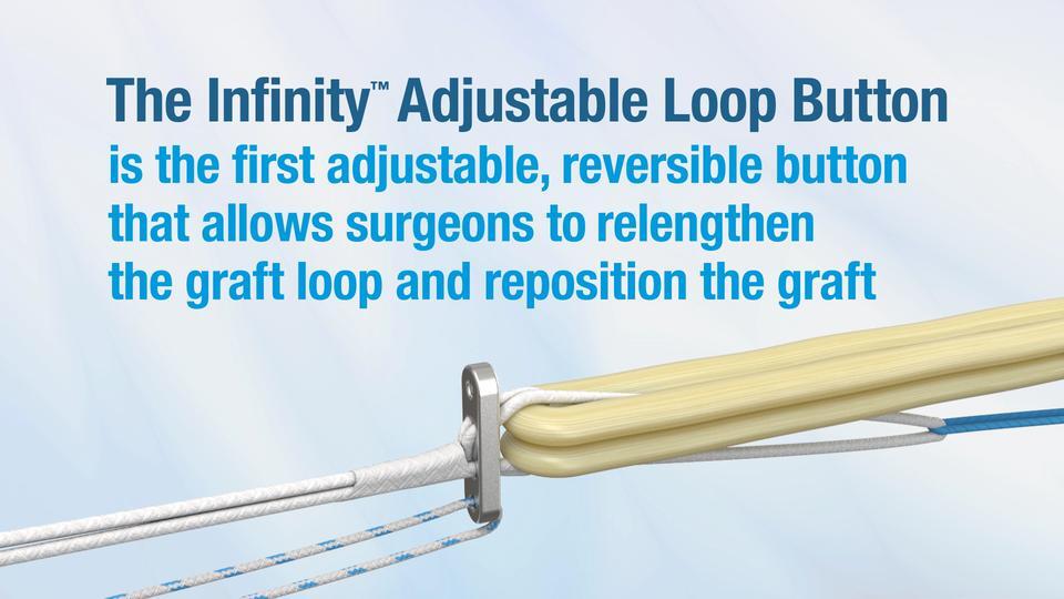 Infinity™ Femoral Adjustable Loop Button - Product Video