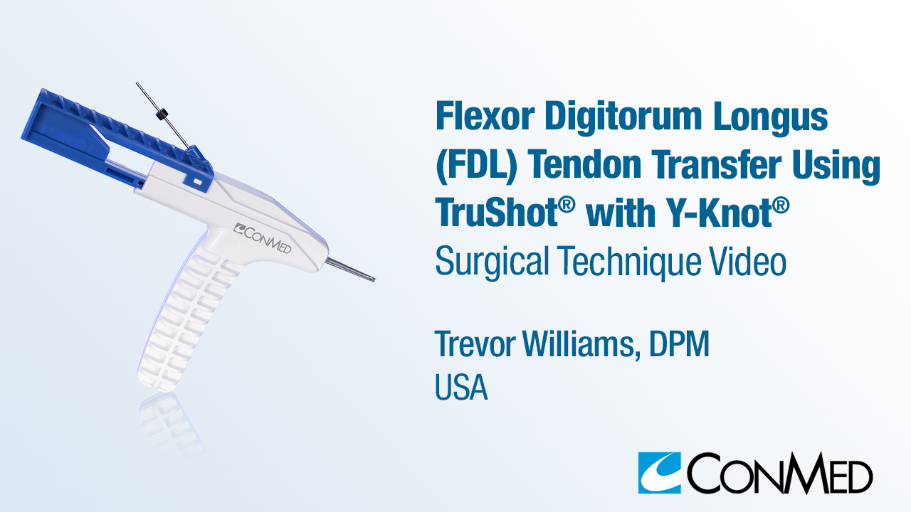 Dr. Williams - FDL Tendon Transfer Using TruShot® with Y-Knot®